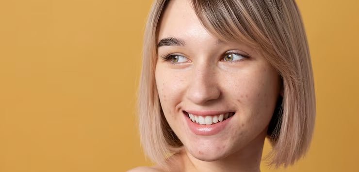 10 Best Products to Brighten Dull Skin In India 2023 - Rawls Essentials