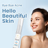 Acne Corrector Face Gel - Acne Minimizing Gel for Oily & Sensitive Skin - 10 ml