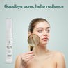 Acne Corrector Face Gel - Acne Minimizing Gel for Oily & Sensitive Skin - 10 ml - Rawls Essentials