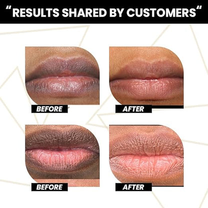 Lip Lightener - Smokers Balm - 4 ml - Rawls Essentials