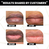 Lip Lightener - Smokers Balm - 4 ml - Rawls Essentials